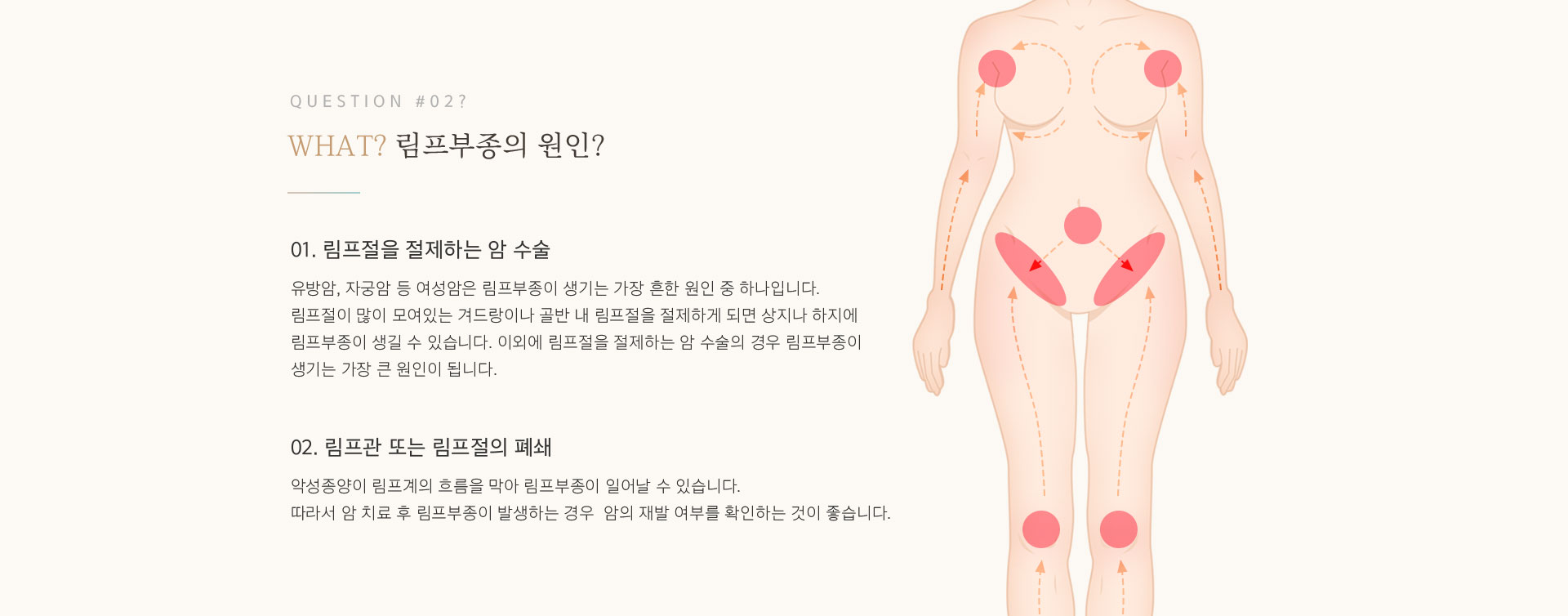 림프부종 개선 원인